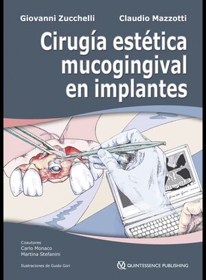 Cirugía estética mucogingival en implantes (2 volúmenes)